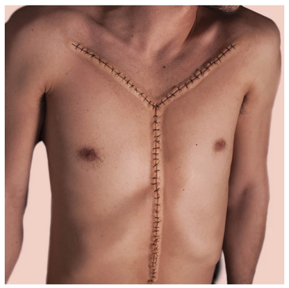 Autopsy suture prosthetic - C18 Silicone Prosthetic Autopsy suture prosthetic - C18 Silicone Prosthetic