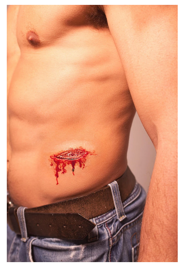 Stab wounds - C2/C17 Silicone Prosthetic