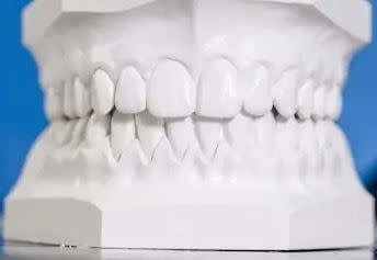 Dental Impression Plaster